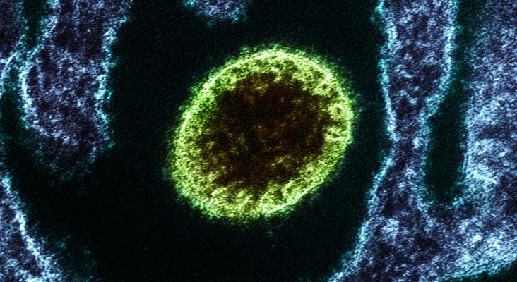 Alerta en el Caribe: El aeropuerto de Santo Domingo (RD) activa controles sanitarios por el virus Nipah