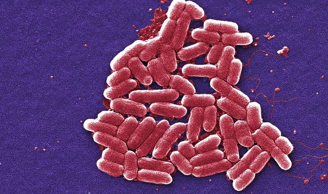 Un adolescente recibe una indemnización de seis cifras de TUI tras contraer E. coli en sus vacaciones