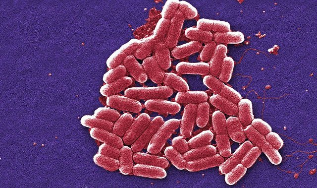 Un adolescente recibe una indemnización de seis cifras de TUI tras contraer E. coli en sus vacaciones Un adolescente recibe una indemnización de seis cifras de TUI tras contraer E. coli en sus vacaciones