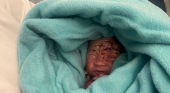 Encuentran un recién nacido en la papelera del baño de un avión de Air Mauritius | Foto: BBC