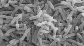 Vibrio cholerae: la bacteria que causa el cólera | Foto: Wikimedia Commons